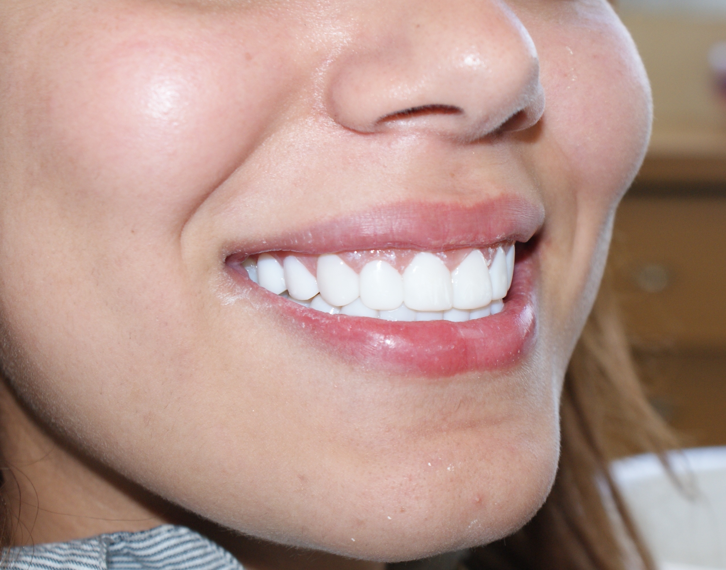 Видны передние зубы. Кэти Топурия виниры. Красивая форма зубов. Идеальные зубы. Красивая форма зубов у женщин.